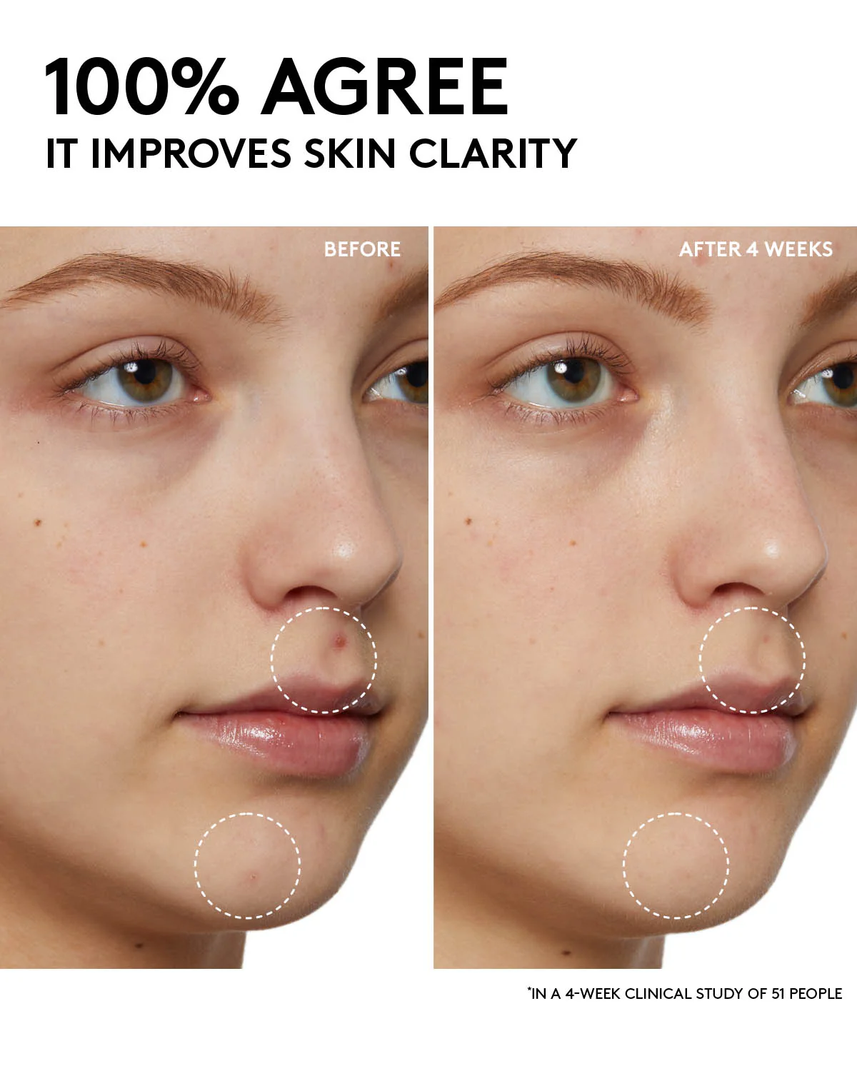 Cherry Dub Pore Purify'r Gel Cleanser with Niacinamide + Aloe Juice - Image 5